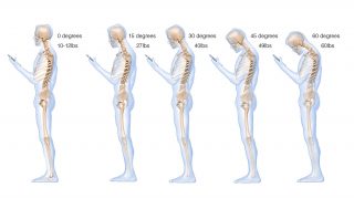 Are smartphones ruining your posture?