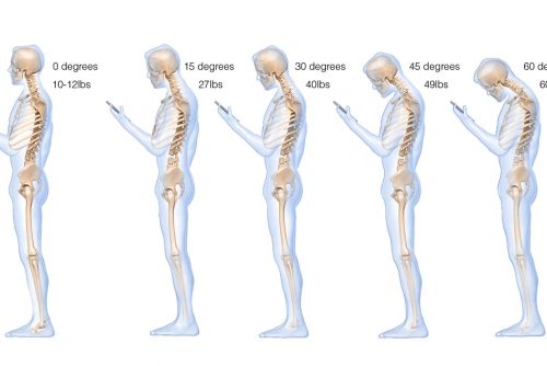 Are smartphones ruining your posture?